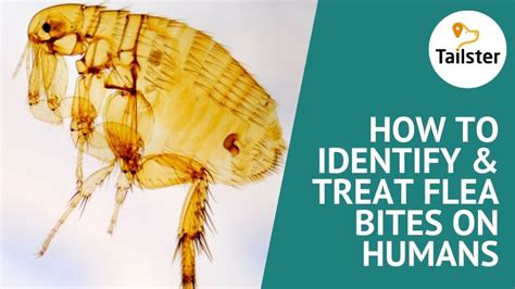 How To Identify And Treat Flea Bites On Humans To Stop That Itch