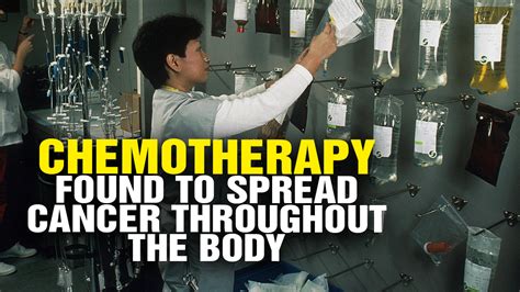 Chemotherapy Found To Spread Cancer Throughout The Body Warn