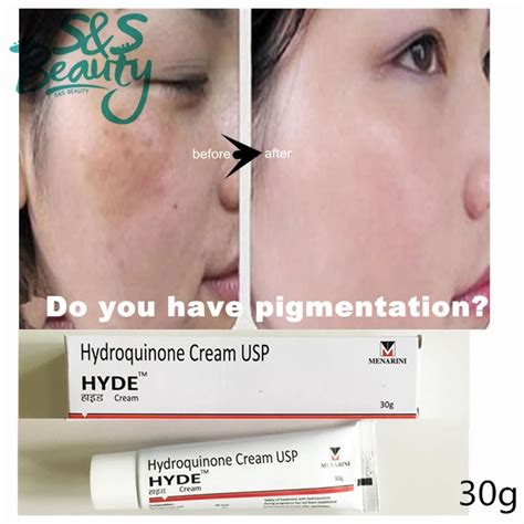 51 skin cream to remove dark spots skincream