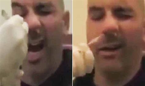 Disgusting Footage Shows A 5 Foot Long Tapeworm Being Extracted From A Mans Nose With Tweezers