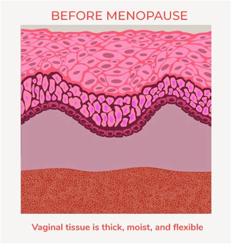 If You Experience Post Menopausal Painful Sex Speak Up Healthywomen