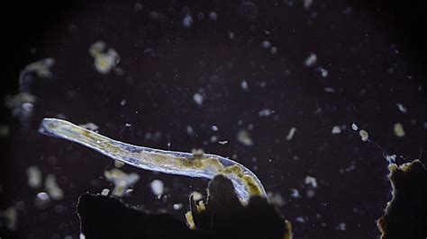 Microscopic Worm From A Pond Youtube