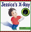Jessica's X-ray - review - Association for the Wellbeing of Children in ...