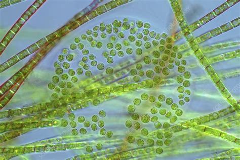 Colonial Green And Filamentous Algae Light Micrograph Stock Image