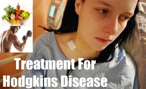 Treatment For Hodgkins Disease How To Treat Hodgkins Disease