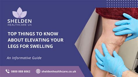 Shelden Healthcare How Long To Elevate Legs To Reduce Swelling Updated Guide Shelden Healthcare