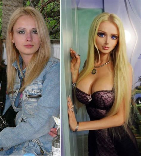 Real Life People Who Have Become Dolls Celebrity Plastic Surgery Plastic Surgery Barbie Girl
