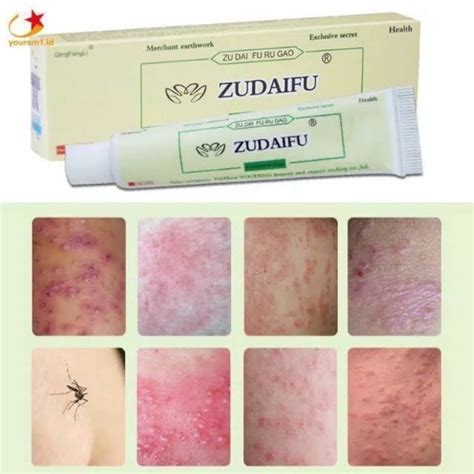 Jual Zudaifu Salep Eksim Obat Cina Gatal Original Salep Psoarisis