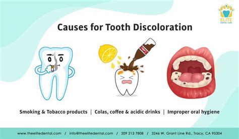 Causes Of Tooth Discoloration Dental Care Discolored Teeth Dentist In