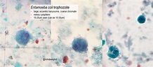 Entamoeba coli trophozoite on Microscopy - large, ... | GrepMed