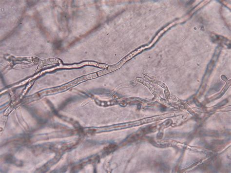 Tamuplpa631fungalbloglornanissen Lab 6