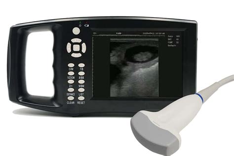 Pig Goat Handheld Eci3000 Veterinary Portable Ultrasound Machine
