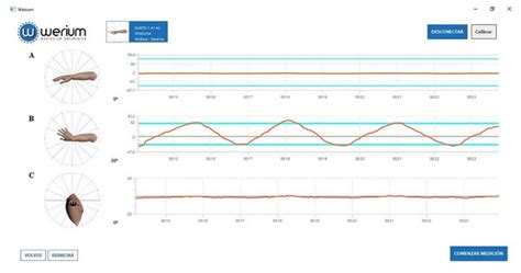 Validity And Reliability Of Inertial Sensors For Elbow And Wrist Range