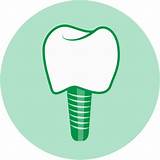 Images of Emergency Dental Implants