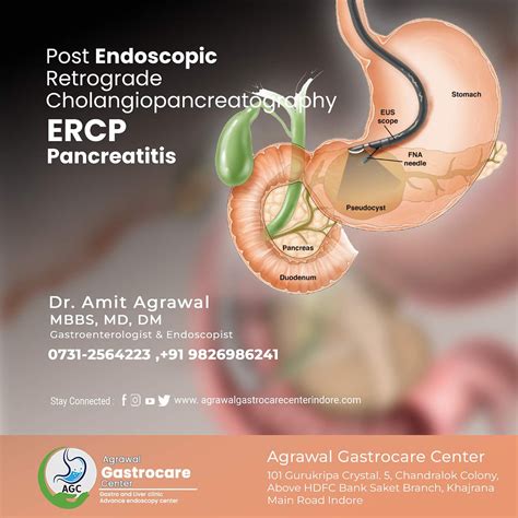 Post Ercp Pancreatitis By Agrawal Gastrocare Center Indore On Dribbble