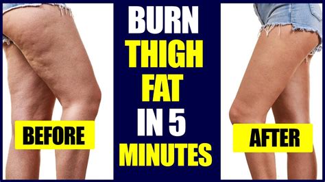 SLIMMER LEGS In 10 Days Get Slim Legs With Easy Workout Exercises