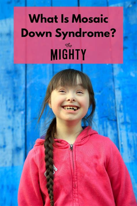 What You Should Know About Mosaic Down Syndrome Downsyndrome Signs Of