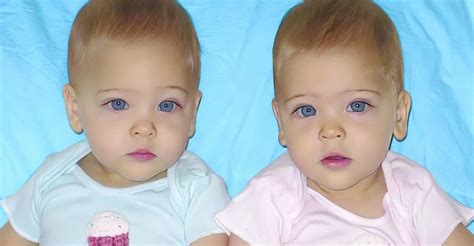 Les plus belles jumelles du monde ont désormais ans à quoi ressemblent telles aujourd