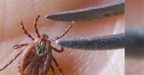New Research May Reveal Why Lyme Disease Causes Chronic Symptoms For Some