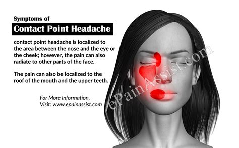 Contact Point Headachecausessymptomssignstreatmentdiagnosis