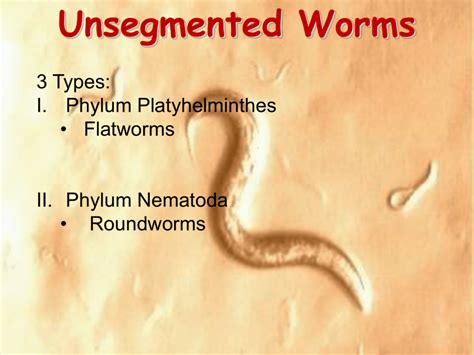 The Difference Between Flatworms And Roundworms Scien