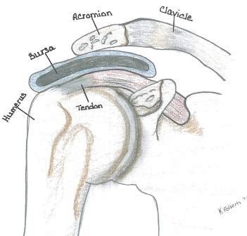 Always practice good posture throughout the day. Impingement Syndrome | Corporate