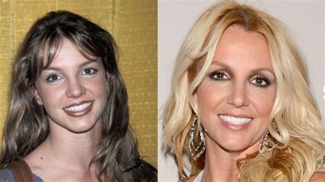 Britney Spears Plastic Surgery Then And Now Pictures Of The Singer