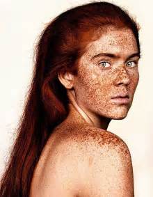 Unique Beauty Of Freckled People Documented By Brock Elbank