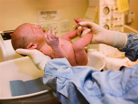 Circumcision Rates Declining In Us Infants Raising Health Risks Later In Life Cbs News