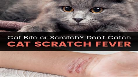 6 Natural Ways To Treat Cat Scratch Fever Symptoms How To Prevent Cat
