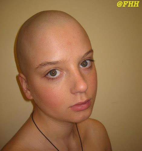 Bald Women Bald Women Keanu Ronin Flickr