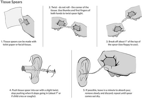 Plain Language Summary Tympanostomy Ear Tubes In Children Richard