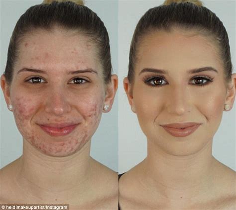 Youtube Vlogger Heidi Hamoud Shows How To Cover Acne Using Foundation