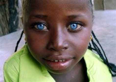 Australian Aborigines Blonde Hair Blue Eyes