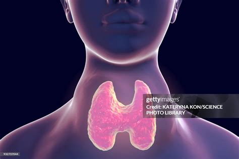 Thyroid Goitre Illustration High Res Vector Graphic Getty Images