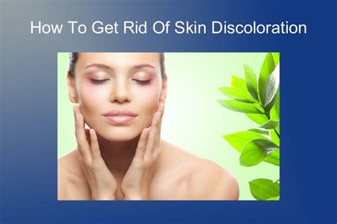What Does Discolored Skin Mean Heidi Salon