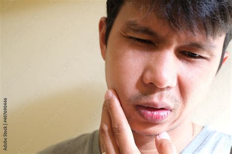 Teetch Problem Asian Male With Painful Cheek Swelling Or Dental