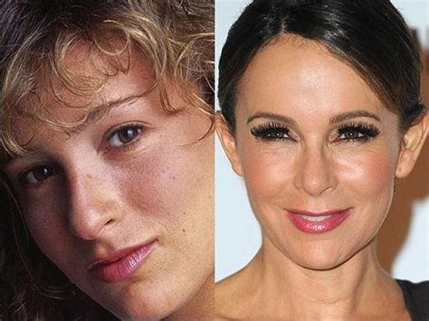 Jennifer Grey Plastic Surgery Before And After Photos Plastic Surgery Celebrity Plastic