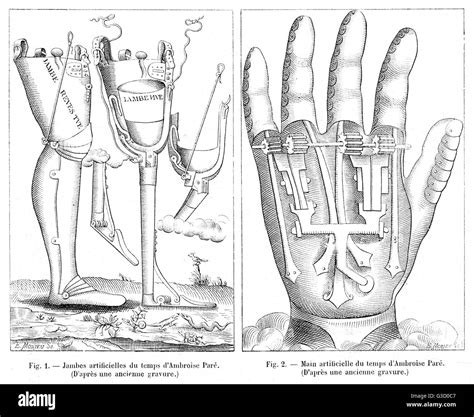 amputation de la main banque d images détourées alamy