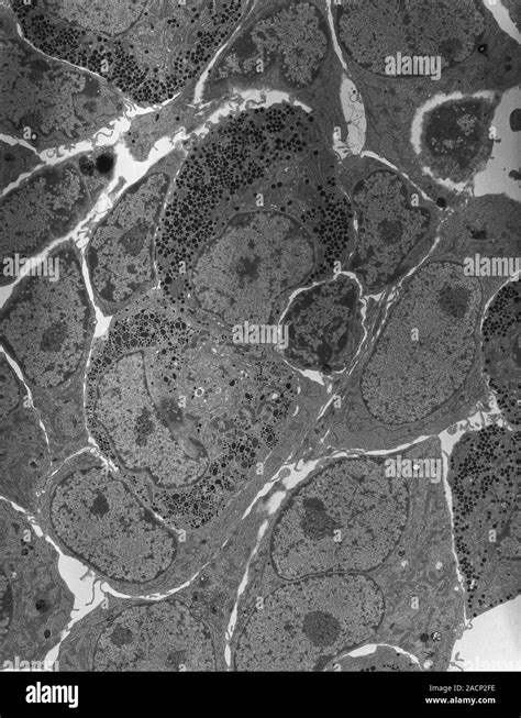 Anterior Pituitary Gland Transmission Electron Micrograph Tem Of A