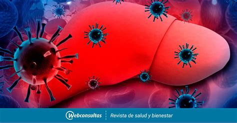 Molecular diagnostics of hepatitis c virus infection: Hepatitis, qué es y consecuencias