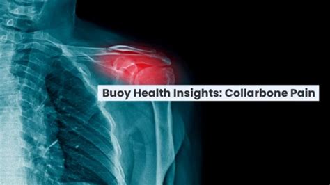 Collarbone Pain Common Causes And When To Seek Medical Care