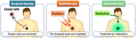 Radiotherapy And Chemotherapy All About Radiation