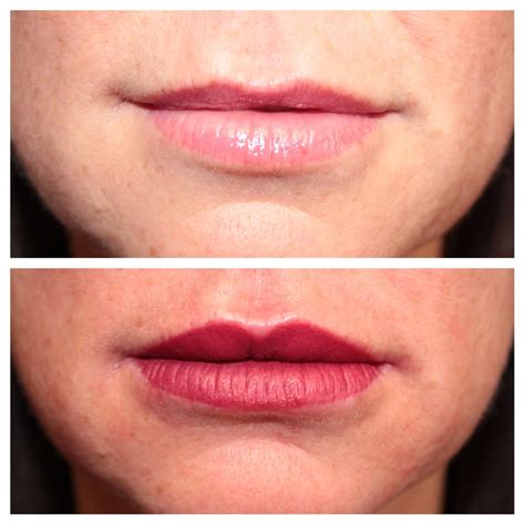 Full Permanent Lip Color Immediately After Procedure Yelp