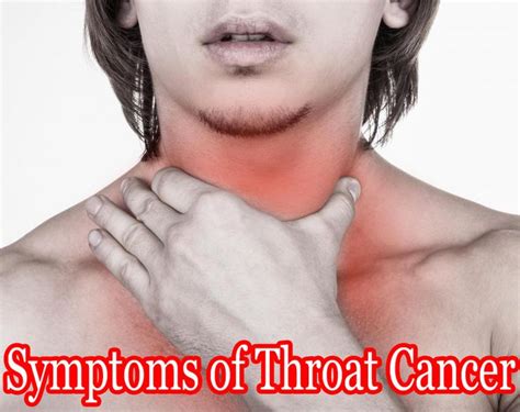 What Are The Symptoms Of Throat Cancer In Malayalam Throat Cancer