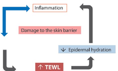 Relationship Between Damage Of The Skin Barrier And Skin Inflammation