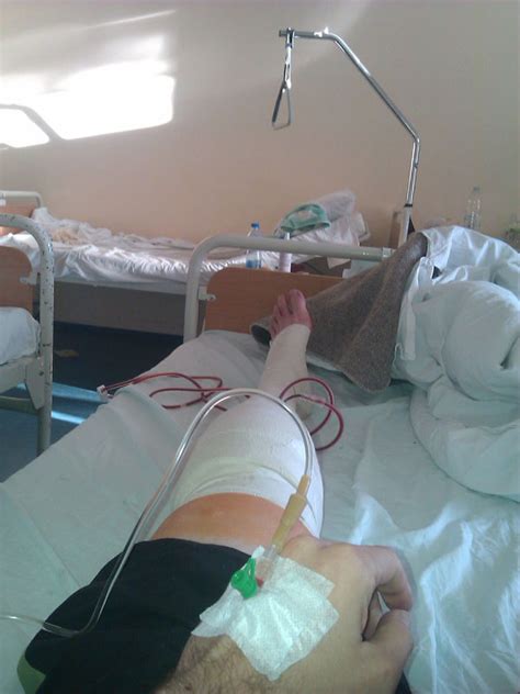 Operacija kolena (ligamentoplastika i meniskus) - Duletov blog
