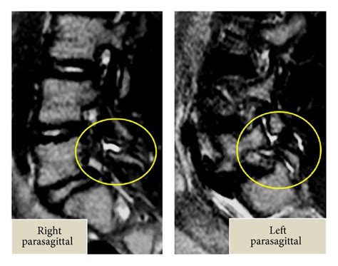 Imaging Of The Spine And Spinal Cord Concise Medical Knowledge