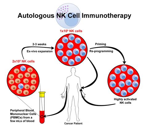 Autologous Nk Cell Immunotherapy Stem Cells 21
