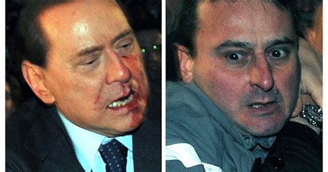 Silvio Berlusconi Hit In The Face At Milan Rally